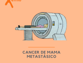 Cáncer de mama metastásico